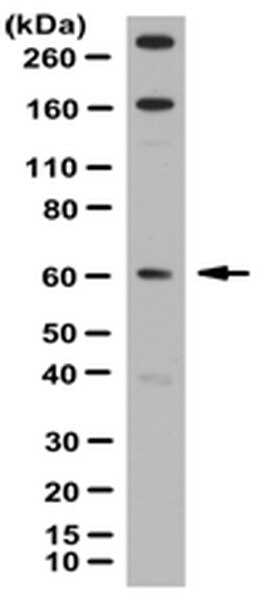 Anti-TTC8 Antibody | ABN209